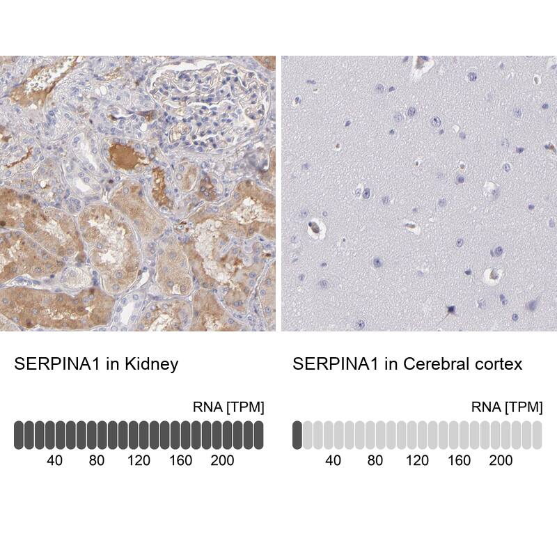 Serpin A1/alpha 1-Antitrypsin Antibody - BSA Free Immunohistochemistry: Serpin A1/alpha 1-Antitrypsin Antibody - BSA Free [NBP1-90308]