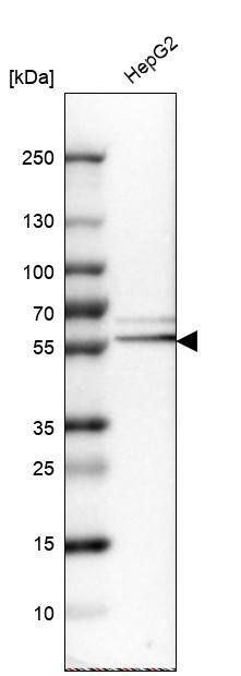 Serpin A1/alpha 1-Antitrypsin Antibody - BSA Free Western Blot: Serpin A1/alpha 1-Antitrypsin Antibody - BSA Free [NBP1-90308]