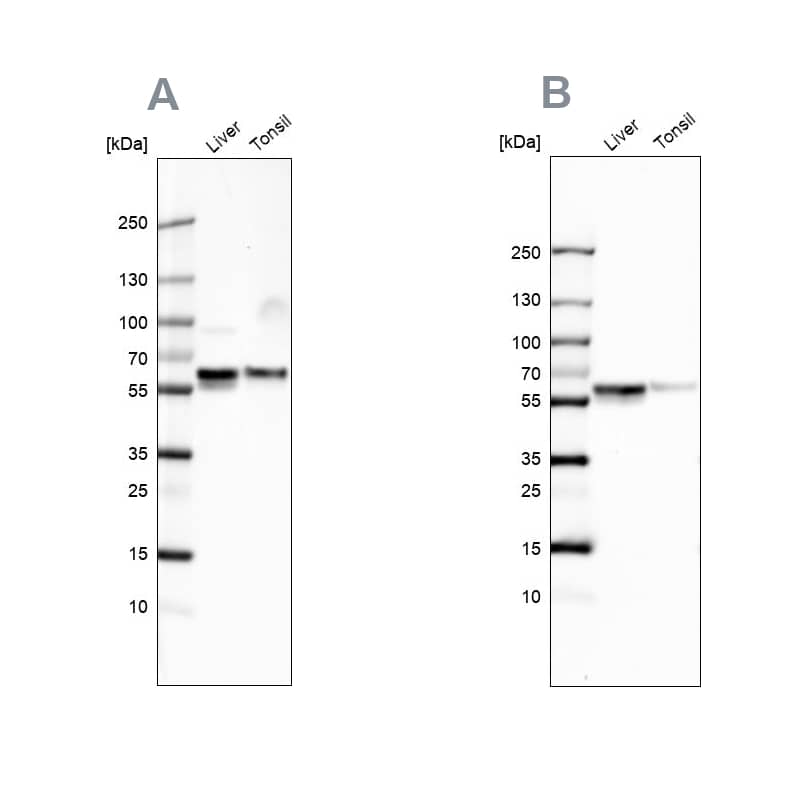 Serpin A1/alpha 1-Antitrypsin Antibody - BSA Free Western Blot: Serpin A1/alpha 1-Antitrypsin Antibody - BSA Free [NBP1-90309]