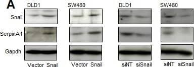 Serpin A1/alpha 1-Antitrypsin Antibody