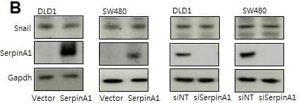 Serpin A1/alpha 1-Antitrypsin Antibody