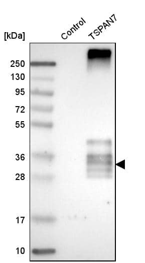 TSPAN7/TM4SF2 Antibody - BSA Free Western Blot: TSPAN7/TM4SF2 Antibody - BSA Free [NBP1-90310]