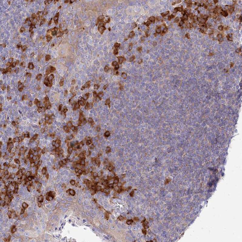 Protein O-Glucosyltransferase 1/POGLUT1/KTELC1 Antibody - BSA Free Immunohistochemistry: Protein O-Glucosyltransferase 1/POGLUT1/KTELC1 Antibody - BSA Free [NBP1-90311]