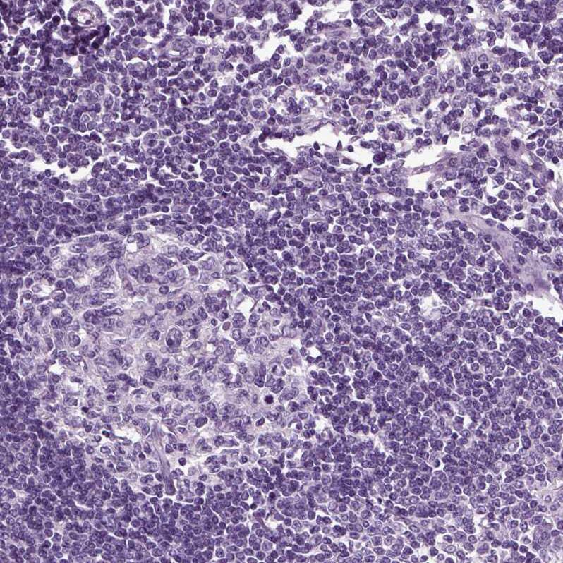Secretogranin V Antibody - BSA Free Immunohistochemistry: Secretogranin V Antibody - BSA Free [NBP1-90312]