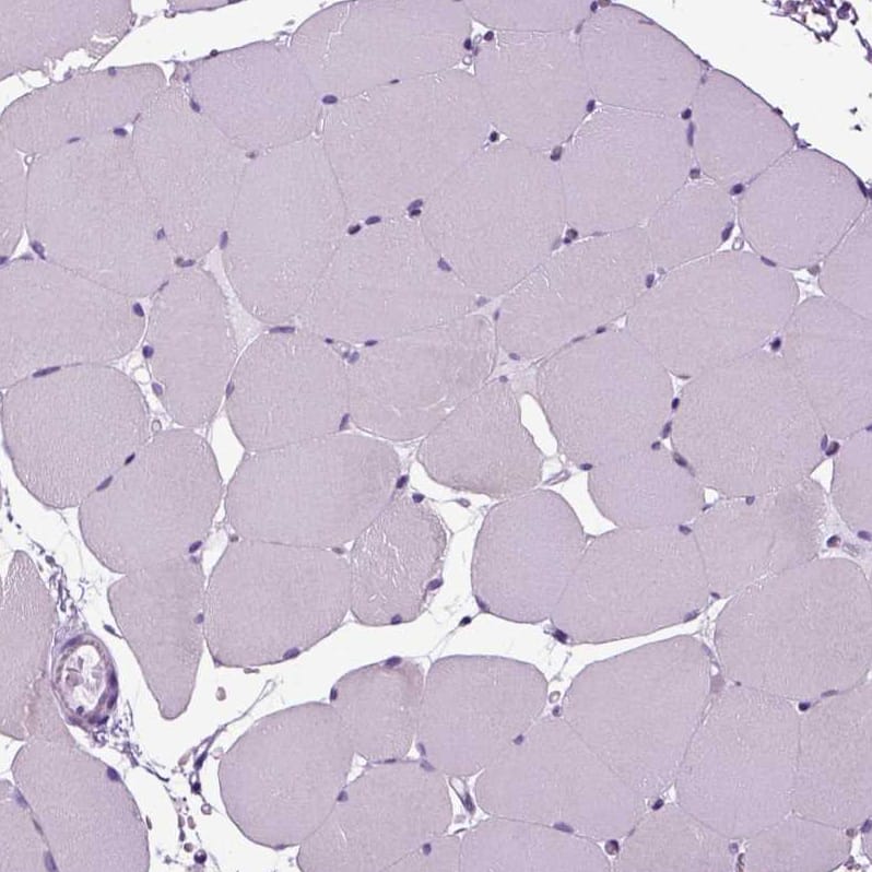 Secretogranin V Antibody - BSA Free Immunohistochemistry: Secretogranin V Antibody - BSA Free [NBP1-90312]