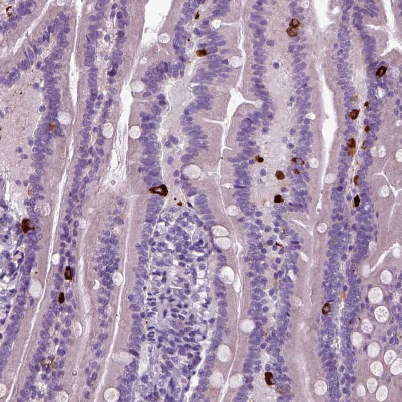 Secretogranin V Antibody - BSA Free Immunohistochemistry: Secretogranin V Antibody - BSA Free [NBP1-90312]