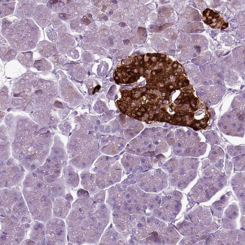 Secretogranin V Antibody - BSA Free Immunohistochemistry: Secretogranin V Antibody - BSA Free [NBP1-90312]