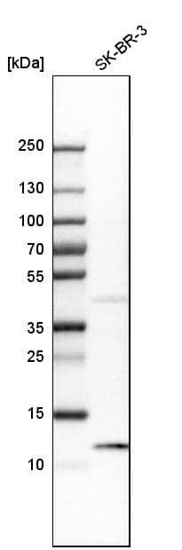 S100A8 Antibody - BSA Free Western Blot: S100A8 Antibody - BSA Free [NBP1-90314]