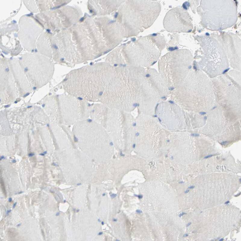 5-HT1F Antibody - BSA Free Immunohistochemistry: 5-HT1F Antibody - BSA Free [NBP1-90319]