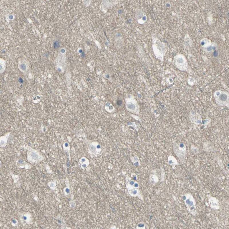 5-HT1F Antibody - BSA Free Immunohistochemistry: 5-HT1F Antibody - BSA Free [NBP1-90319]