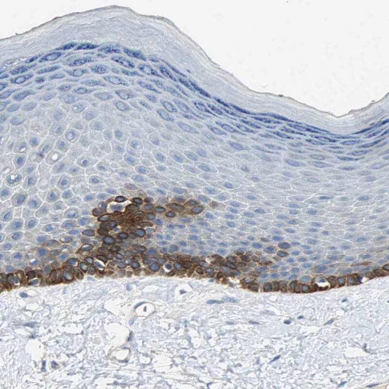 5-HT1F Antibody - BSA Free Immunohistochemistry: 5-HT1F Antibody - BSA Free [NBP1-90319]