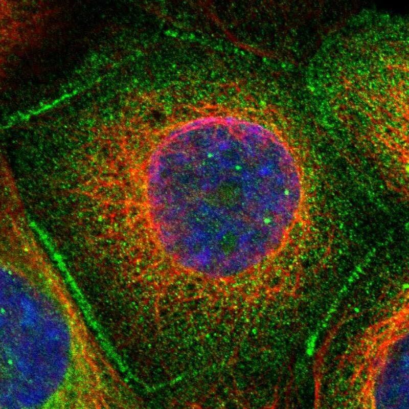 53BP2 Antibody - BSA Free Immunocytochemistry/ Immunofluorescence: 53BP2 Antibody [NBP1-90324]