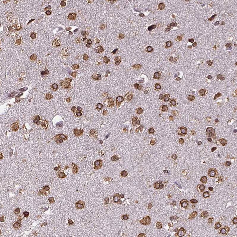 Metadherin Antibody - BSA Free Immunohistochemistry: Metadherin Antibody - BSA Free [NBP1-90327]