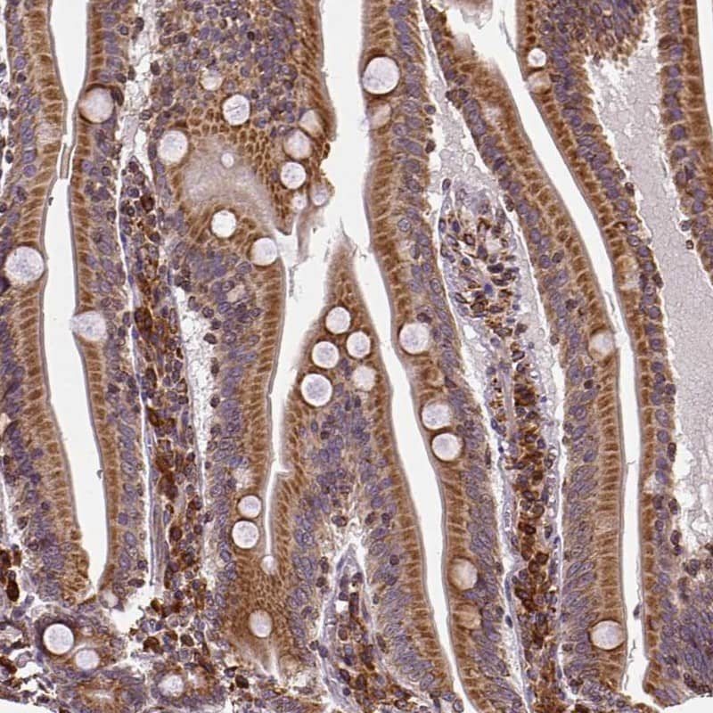 Metadherin Antibody - BSA Free Immunohistochemistry: Metadherin Antibody - BSA Free [NBP1-90328]