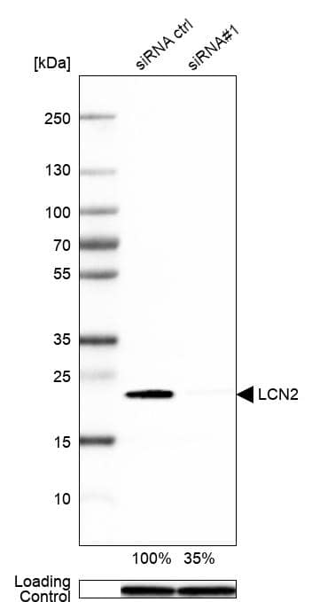 Lipocalin-2/NGAL Antibody - BSA Free Western Blot: Lipocalin-2/NGAL Antibody - BSA Free [NBP1-90331]