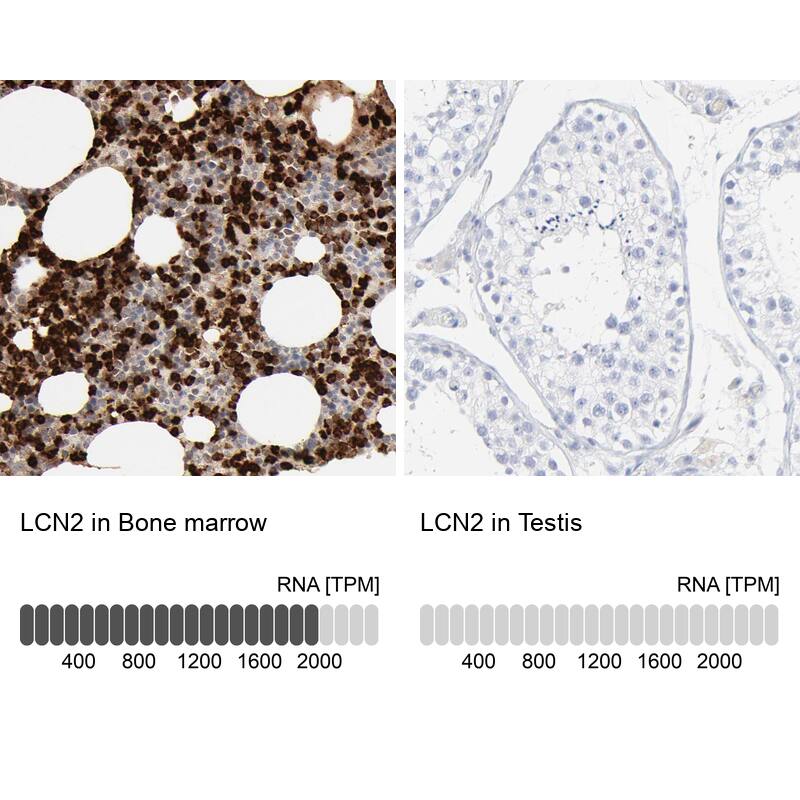 Lipocalin-2/NGAL Antibody - BSA Free Immunohistochemistry: Lipocalin-2/NGAL Antibody - BSA Free [NBP1-90331]