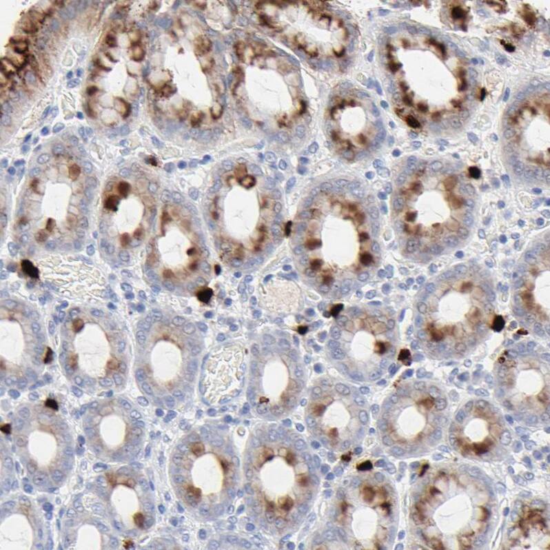 Lipocalin-2/NGAL Antibody - BSA Free Immunohistochemistry: Lipocalin-2/NGAL Antibody - BSA Free [NBP1-90331]
