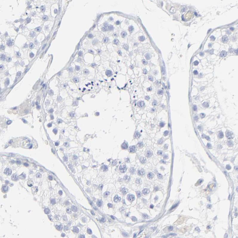 Lipocalin-2/NGAL Antibody - BSA Free Immunohistochemistry: Lipocalin-2/NGAL Antibody - BSA Free [NBP1-90331]