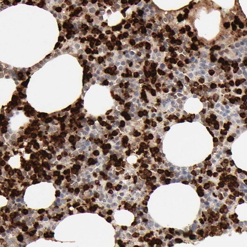 Lipocalin-2/NGAL Antibody - BSA Free Immunohistochemistry: Lipocalin-2/NGAL Antibody - BSA Free [NBP1-90331]