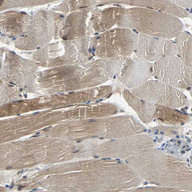 Peroxiredoxin 6 Antibody - BSA Free Immunohistochemistry: Peroxiredoxin 6 Antibody - BSA Free [NBP1-90332]