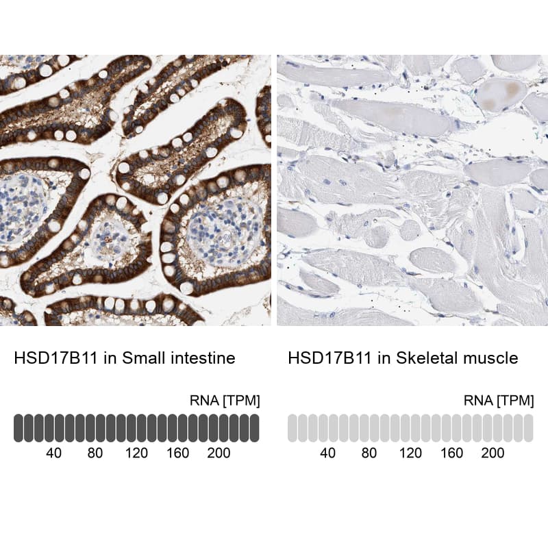 hydroxysteroid (17-beta) dehydrogenase 11 Antibody - BSA Free Immunohistochemistry: hydroxysteroid (17-beta) dehydrogenase 11 Antibody - BSA Free [NBP1-90334]