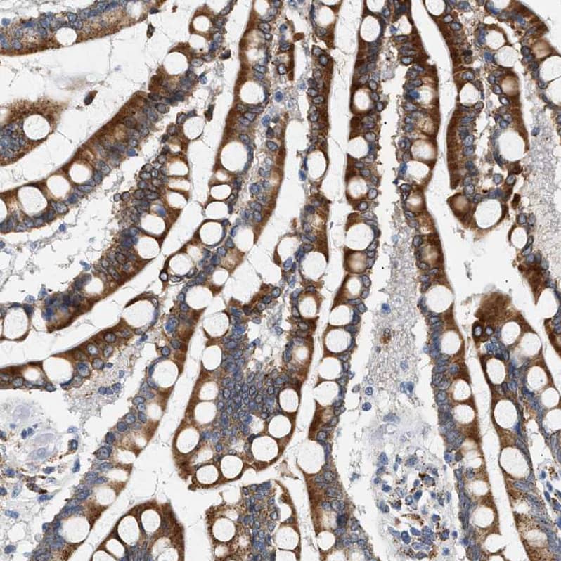 hydroxysteroid (17-beta) dehydrogenase 11 Antibody - BSA Free Immunohistochemistry: hydroxysteroid (17-beta) dehydrogenase 11 Antibody - BSA Free [NBP1-90334]