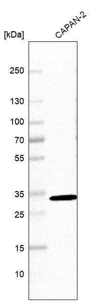 hydroxysteroid (17-beta) dehydrogenase 11 Antibody - BSA Free Western Blot: hydroxysteroid (17-beta) dehydrogenase 11 Antibody - BSA Free [NBP1-90334]