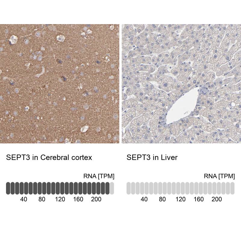 Septin-3 Antibody - BSA Free Immunohistochemistry: Septin-3 Antibody - BSA Free [NBP1-90339]