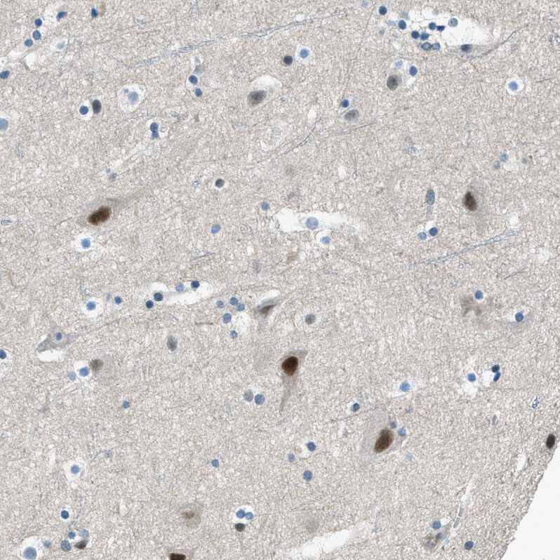 Zeta Opioid Receptor Antibody - BSA Free Immunohistochemistry: Zeta Opioid Receptor Antibody - BSA Free [NBP1-90340]
