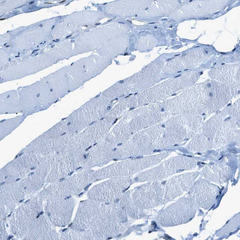 Zeta Opioid Receptor Antibody - BSA Free Immunohistochemistry: Zeta Opioid Receptor Antibody - BSA Free [NBP1-90340]
