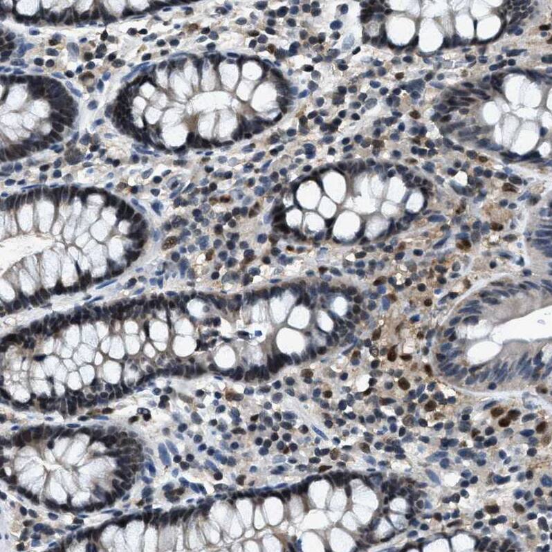 Zeta Opioid Receptor Antibody - BSA Free Immunohistochemistry: Zeta Opioid Receptor Antibody - BSA Free [NBP1-90340]
