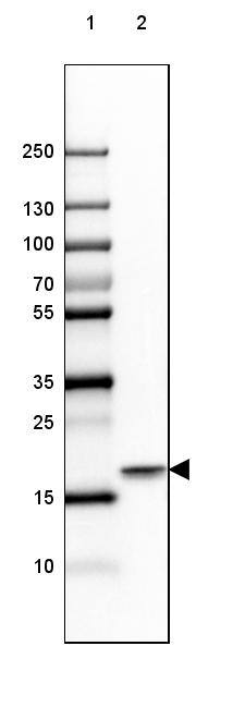 beta-Synuclein Antibody - BSA Free Western Blot: beta-Synuclein Antibody - BSA Free [NBP1-90342]