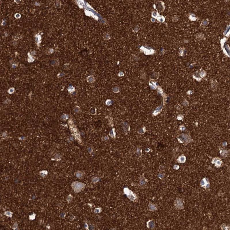 beta-Synuclein Antibody - BSA Free Immunohistochemistry: beta-Synuclein Antibody - BSA Free [NBP1-90342]