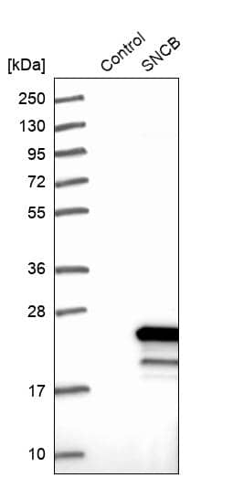 beta-Synuclein Antibody - BSA Free Western Blot: beta-Synuclein Antibody - BSA Free [NBP1-90342]