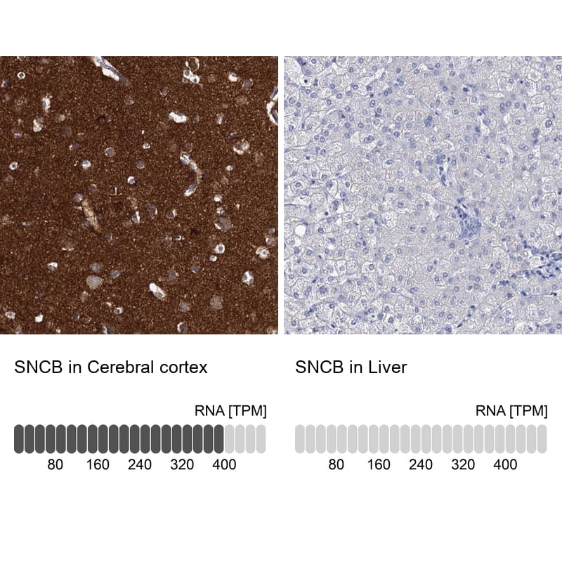 beta-Synuclein Antibody - BSA Free Immunohistochemistry: beta-Synuclein Antibody - BSA Free [NBP1-90342]