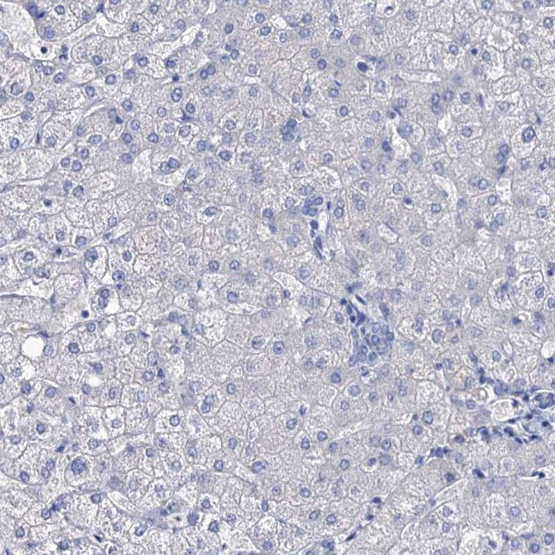 beta-Synuclein Antibody - BSA Free Immunohistochemistry: beta-Synuclein Antibody - BSA Free [NBP1-90342]