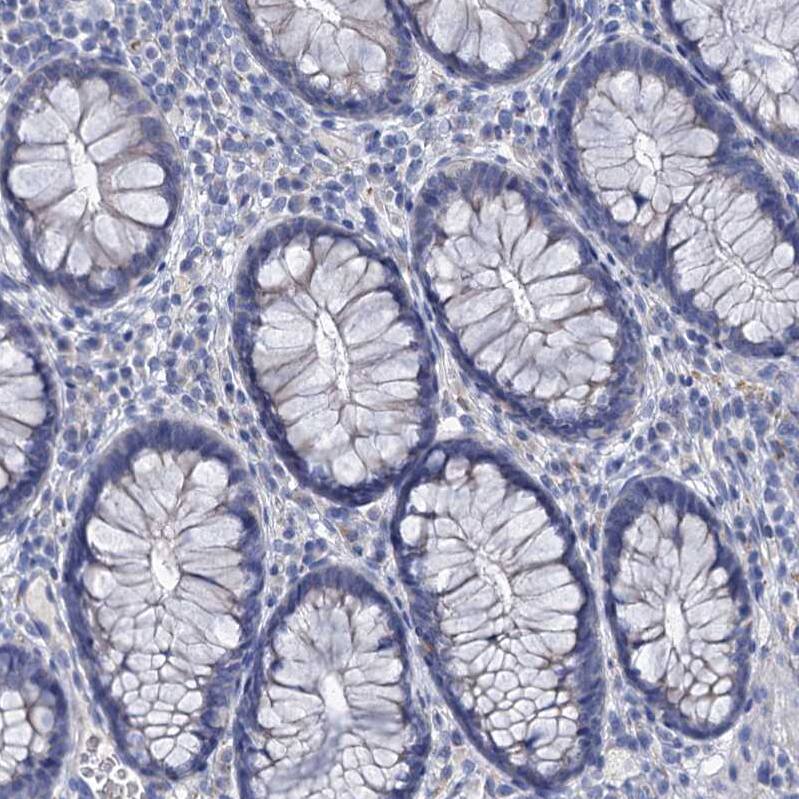 beta-Synuclein Antibody - BSA Free Immunohistochemistry: beta-Synuclein Antibody - BSA Free [NBP1-90342]