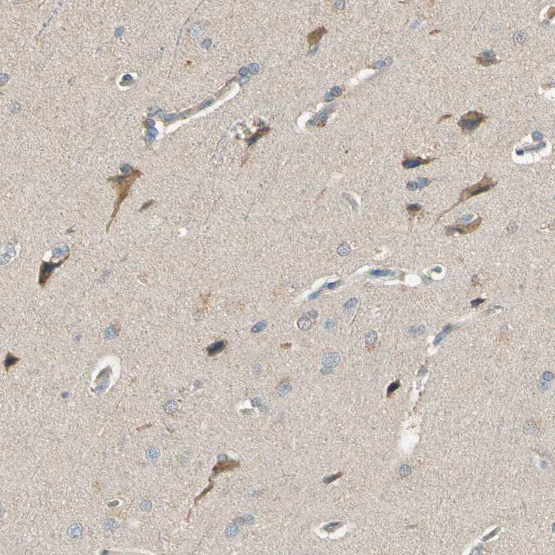 Cadherin-6/KCAD Antibody - BSA Free Immunohistochemistry: Cadherin-6/KCAD Antibody - BSA Free [NBP1-90347]