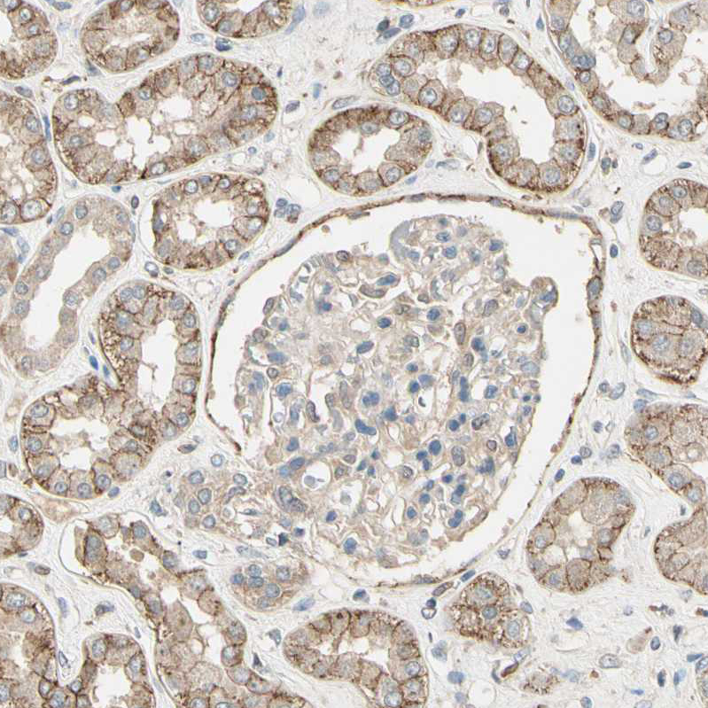 Cadherin-6/KCAD Antibody - BSA Free Immunohistochemistry: Cadherin-6/KCAD Antibody - BSA Free [NBP1-90347]