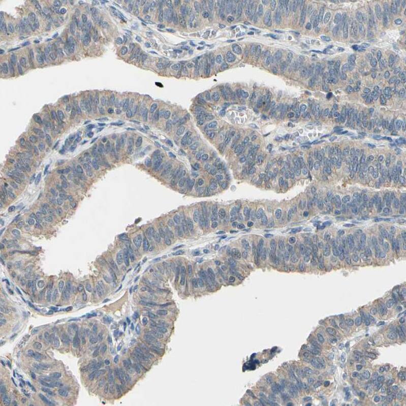 Cadherin-6/KCAD Antibody - BSA Free Immunohistochemistry: Cadherin-6/KCAD Antibody - BSA Free [NBP1-90347]