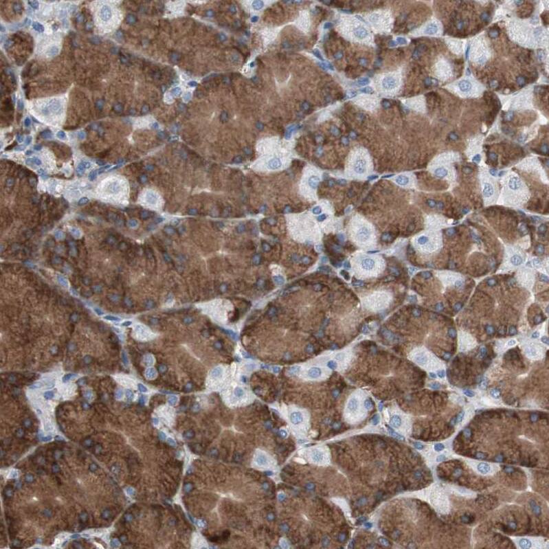 Calumenin Antibody - BSA Free Immunohistochemistry: Calumenin Antibody - BSA Free [NBP1-90348]