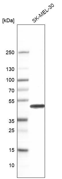 Calumenin Antibody - BSA Free Western Blot: Calumenin Antibody - BSA Free [NBP1-90348]