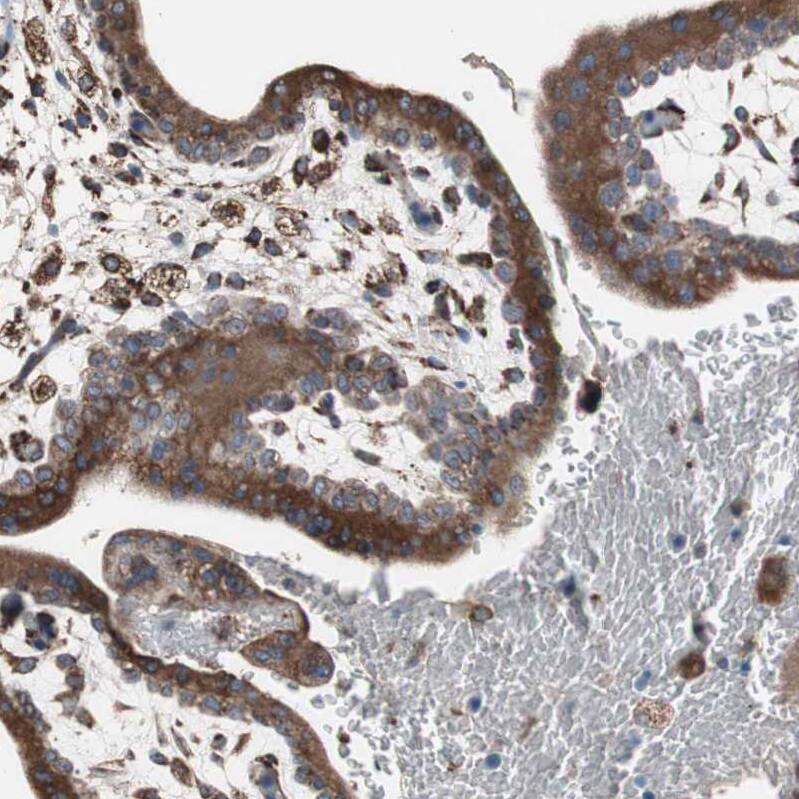 Calumenin Antibody - BSA Free Immunohistochemistry: Calumenin Antibody - BSA Free [NBP1-90348]
