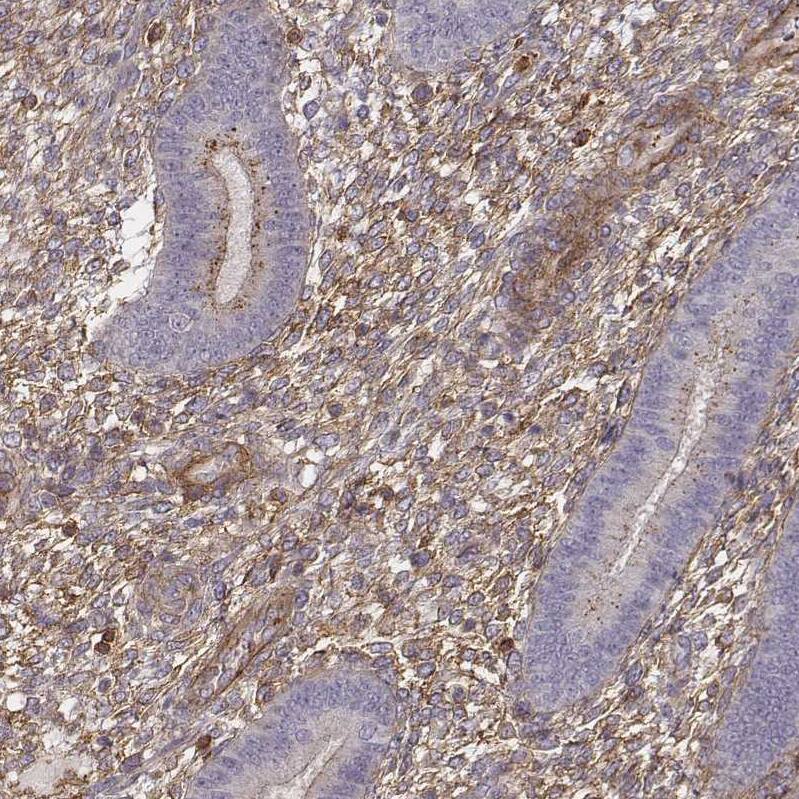 Zyxin Antibody - BSA Free Immunohistochemistry: Zyxin Antibody - BSA Free [NBP1-90349]