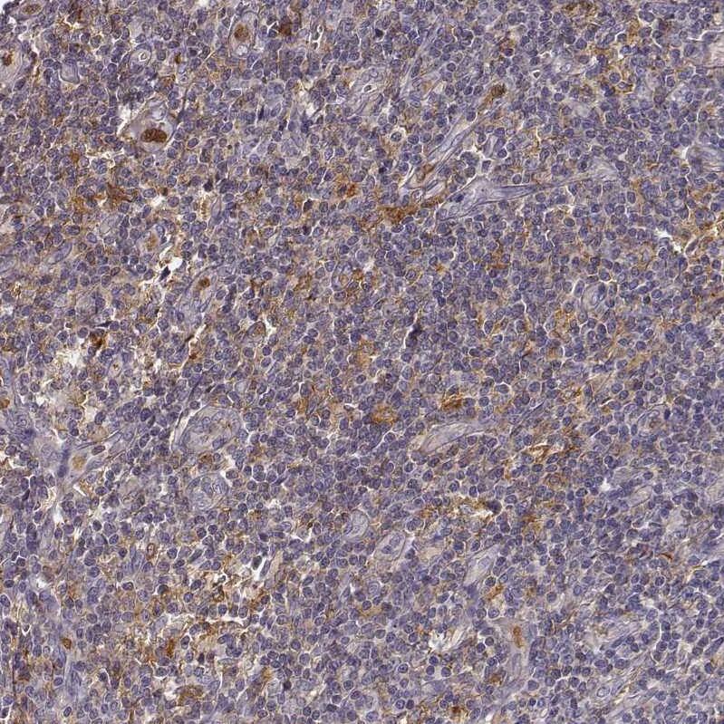 Zyxin Antibody - BSA Free Immunohistochemistry: Zyxin Antibody - BSA Free [NBP1-90349]