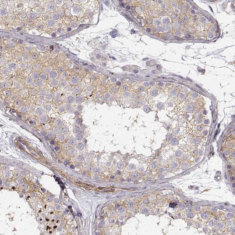 Zyxin Antibody - BSA Free Immunohistochemistry: Zyxin Antibody - BSA Free [NBP1-90349]