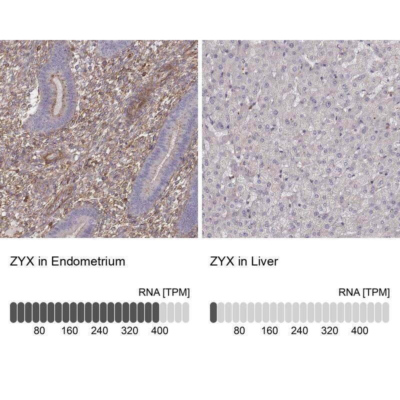 Zyxin Antibody - BSA Free Immunohistochemistry: Zyxin Antibody - BSA Free [NBP1-90349]