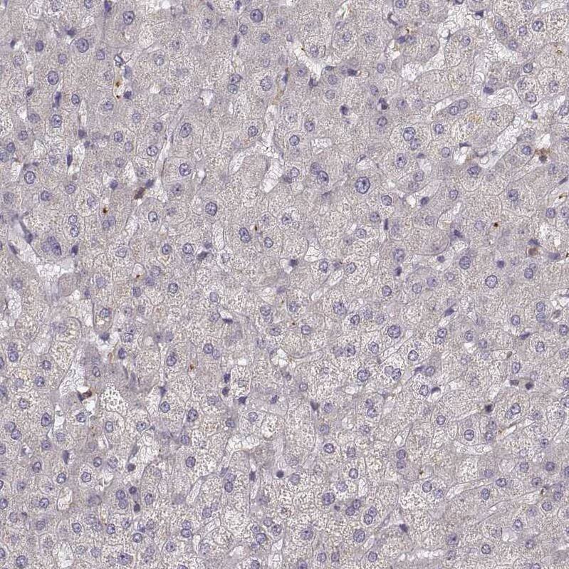 Zyxin Antibody - BSA Free Immunohistochemistry: Zyxin Antibody - BSA Free [NBP1-90349]