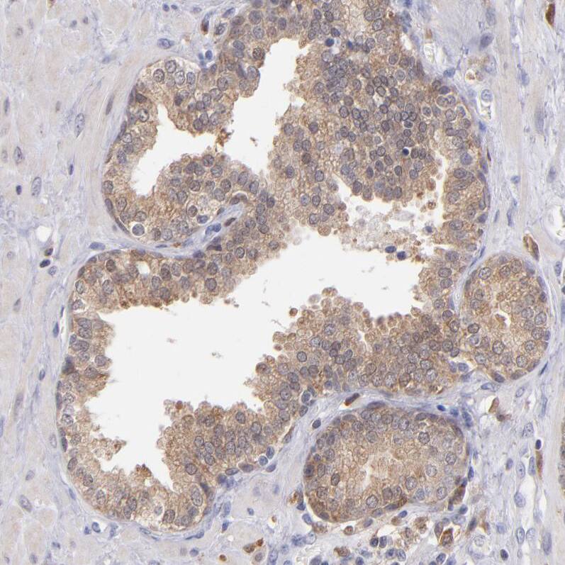PKC delta Antibody - BSA Free Immunohistochemistry: PKC delta Antibody - BSA Free [NBP1-90351]