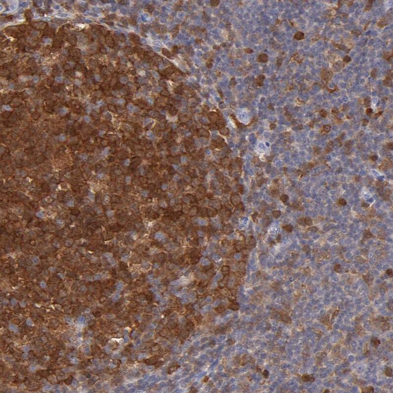 PKC delta Antibody - BSA Free Immunohistochemistry: PKC delta Antibody - BSA Free [NBP1-90351]